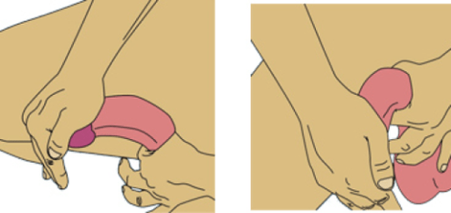 Penis flexion for enlargement